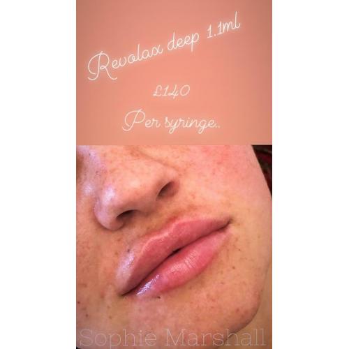 Lip & Facial FILLER