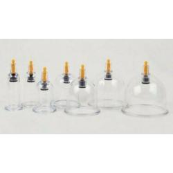 ?30!! Birmingham/Solihull Hijama Cupping Therapy