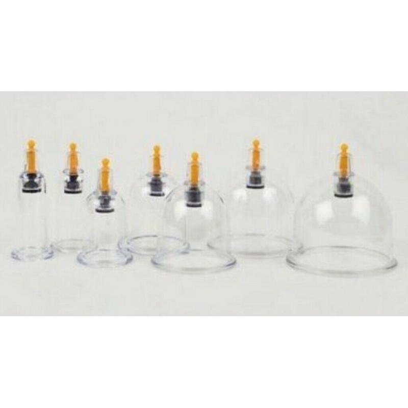?30!! Birmingham/Solihull Hijama Cupping Therapy